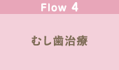 むし歯治療